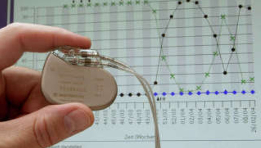 ARRIVA KORA, IL PIÙ PICCOLO PACEMAKER DEL MONDO