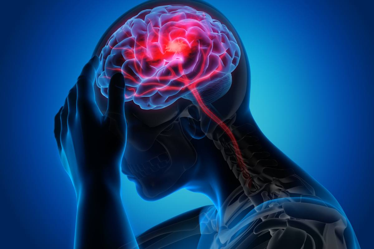 EPILESSIA: ALLO STUDIO  IL NANOPACEMAKER