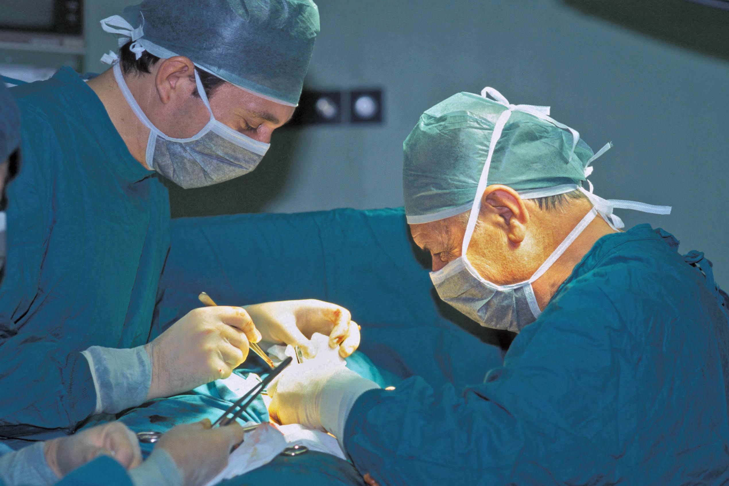 Aneurismi dell’aorta: scoperta nuova causa